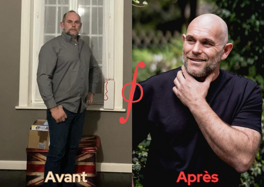 Photo avant après
