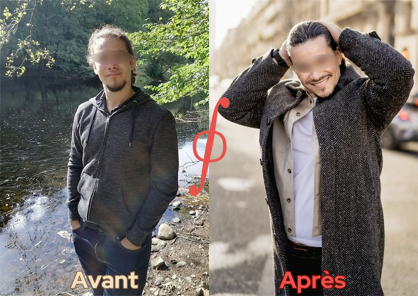 Photo avant après