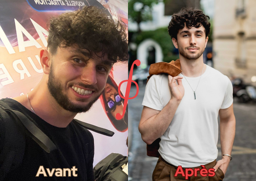 Photo avant après