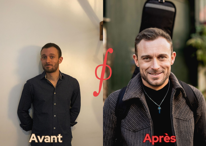 Photo avant après