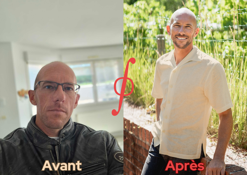 Photo avant après